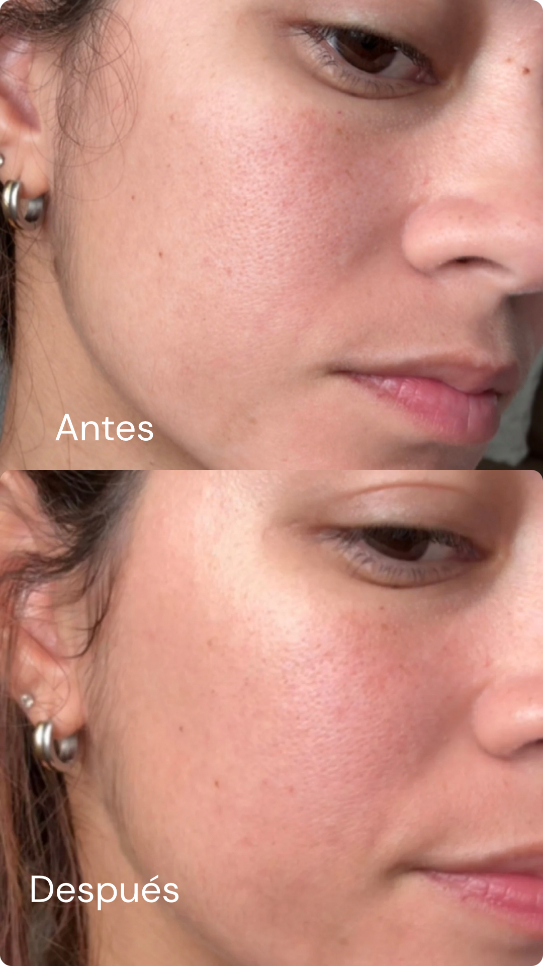 Skin Care Kit- Rutina Completa Nivel Glow